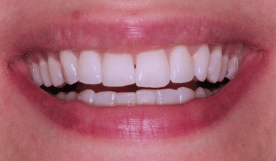 face - Dr Nina Shaffie