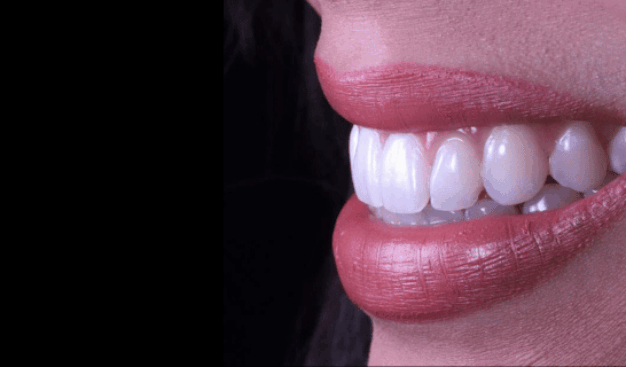 face - Dr Nina Shaffie
