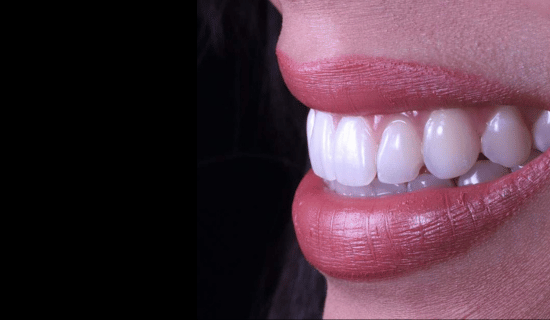 face - Dr Nina Shaffie